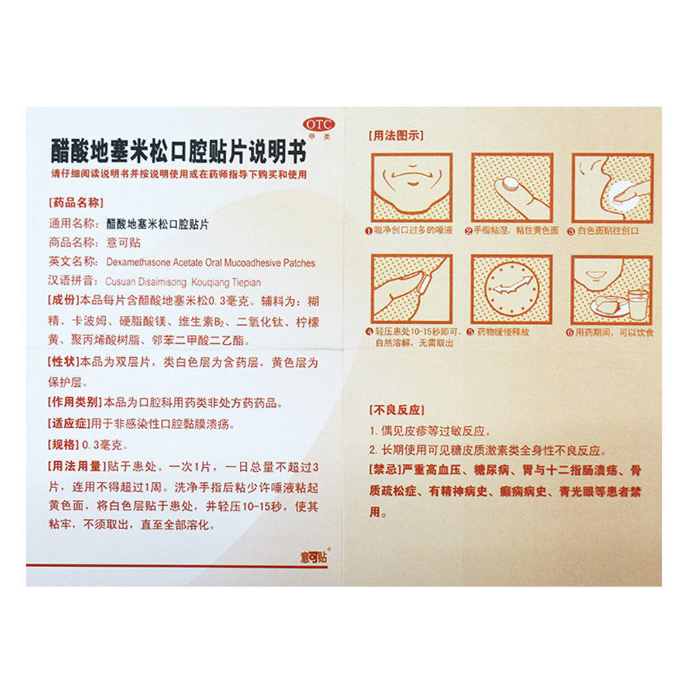 醋酸地塞米松口腔贴片（意可贴）